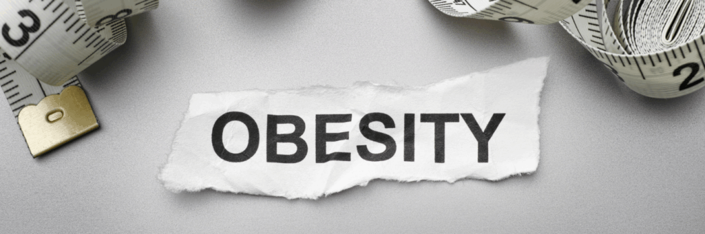 The word 'Obesity' written on distressed white paper